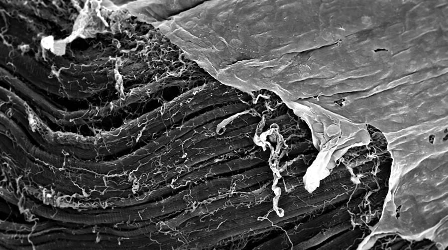 Muscle fibres under a microscope, black and white